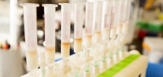 Samples of bovine milk are ready for analysis in the Daniela Barile Food Science Laboratory at UC Davis. (Gregory Urquiaga/UC Davis)